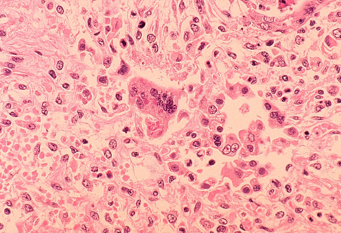 Photo by CDC via Getty Images...